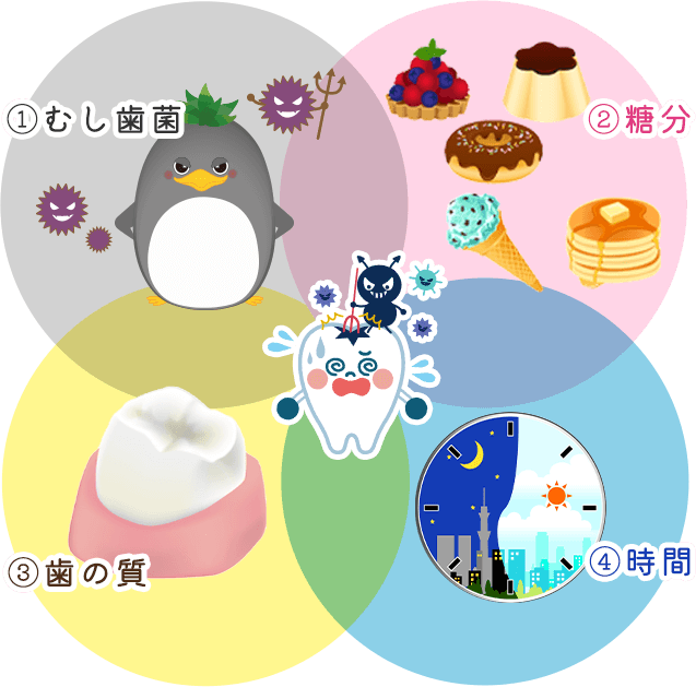 むし歯の4つの原因