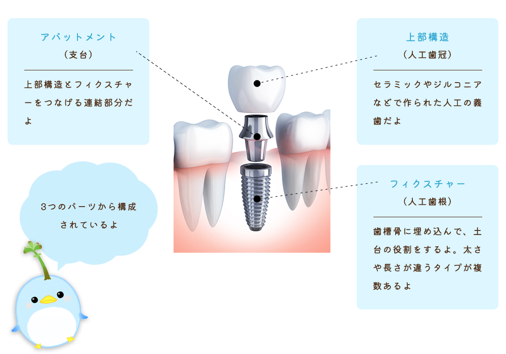 3つのパーツから構成されているよ