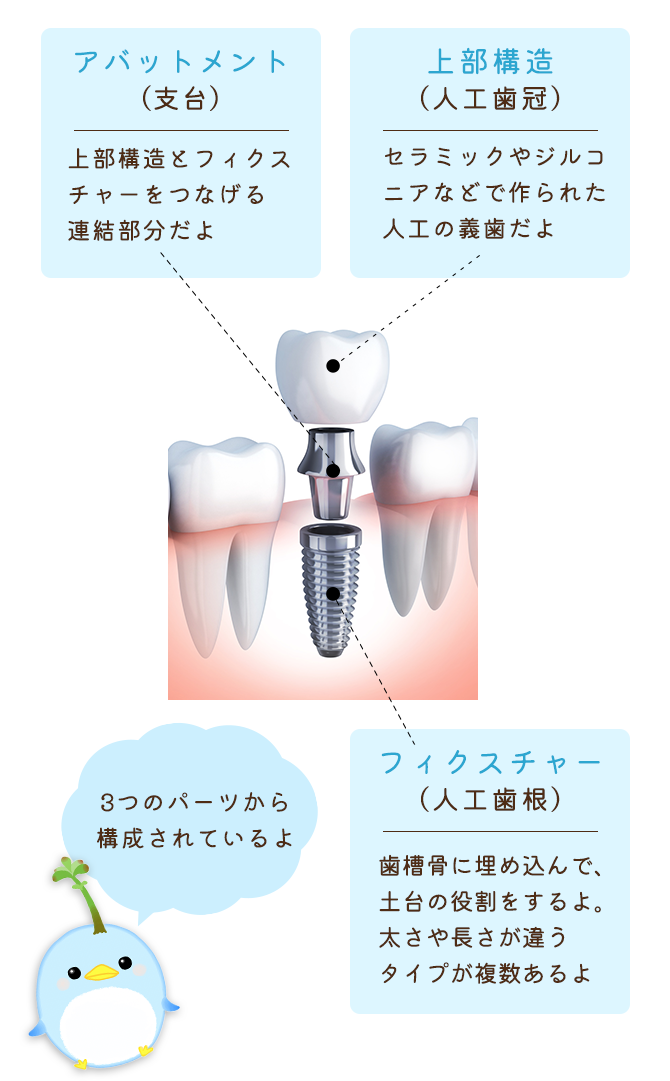 3つのパーツから構成されているよ